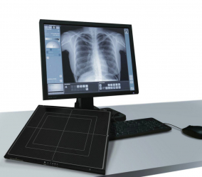 gallery/avanse-dr-digital-radiography-retrofit-wolverson-x-ray-limited2